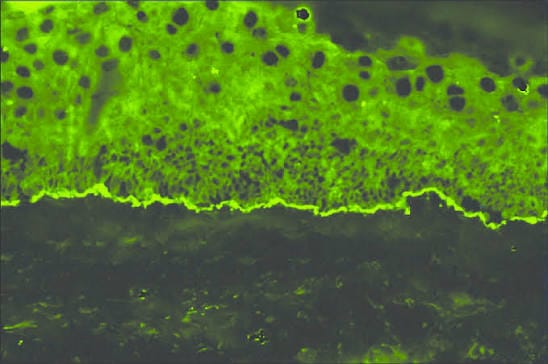 Immunofluorescence Test